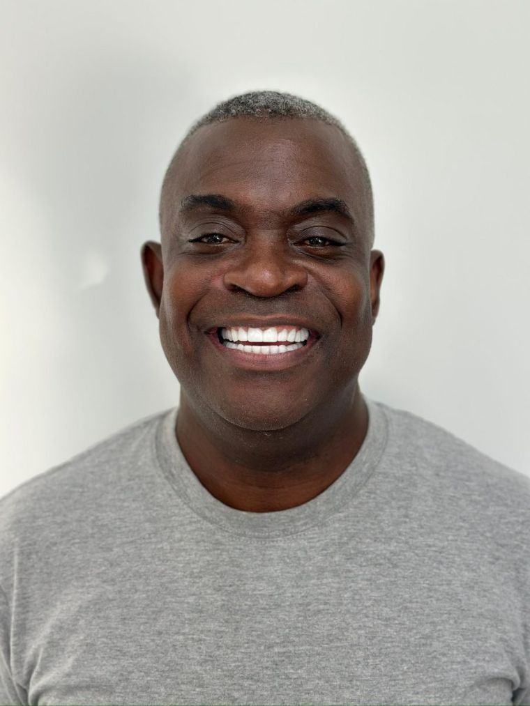 After: full smile makeover with 28 zirconium crowns