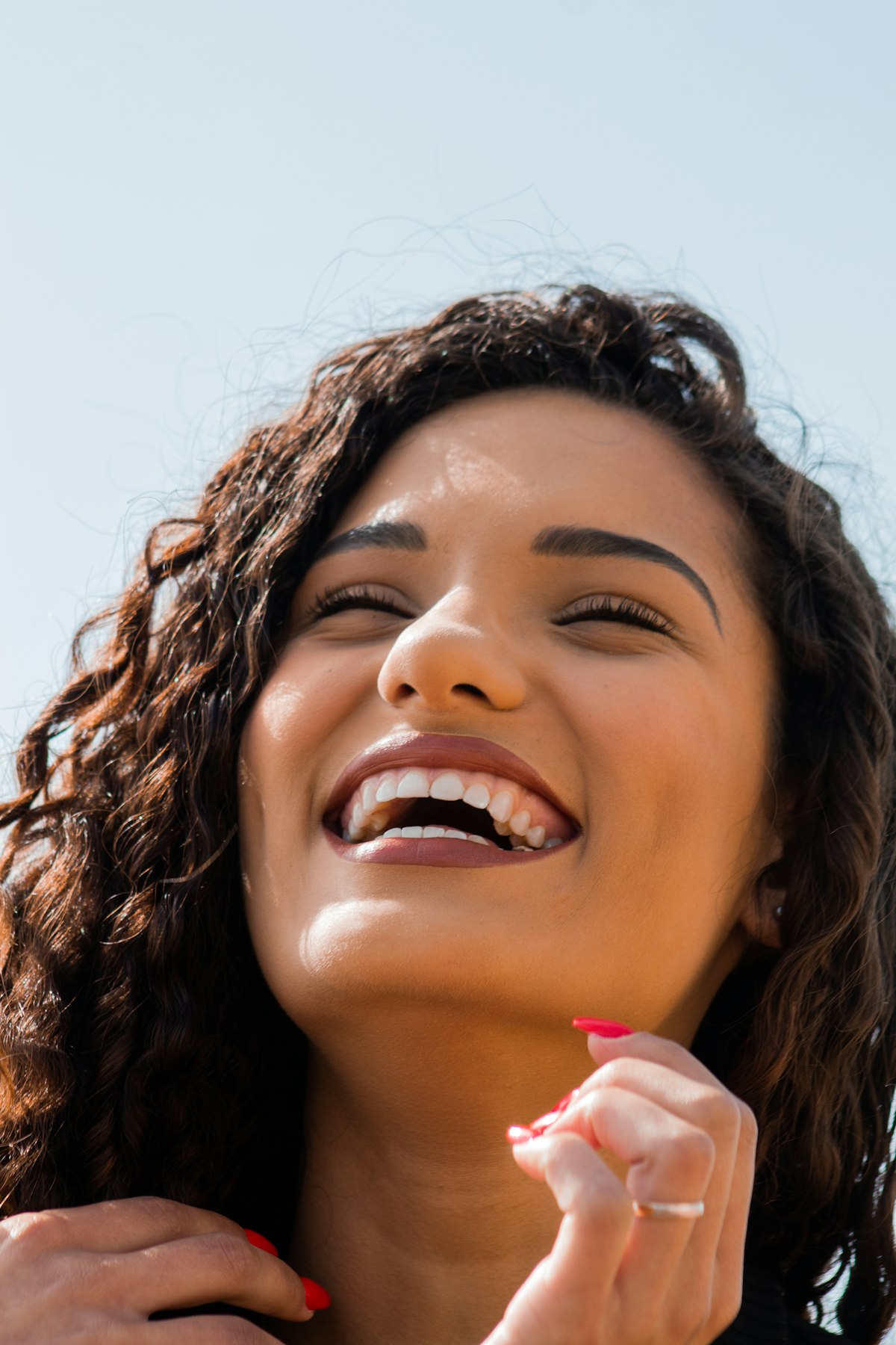 Smile Makeover in Turkey