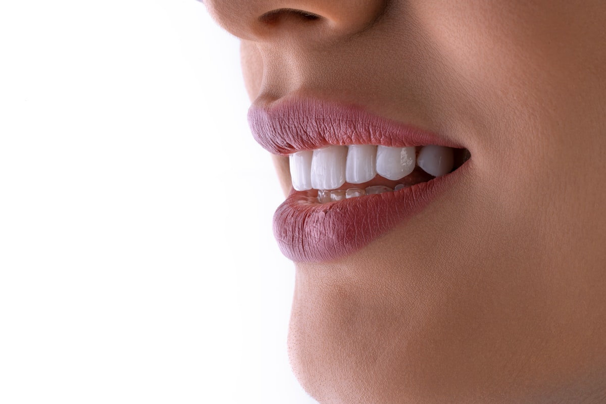 Zirconia Crowns in Turkey